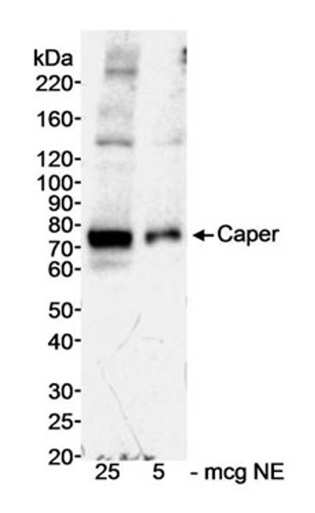 Detection of human Caper by western blot.