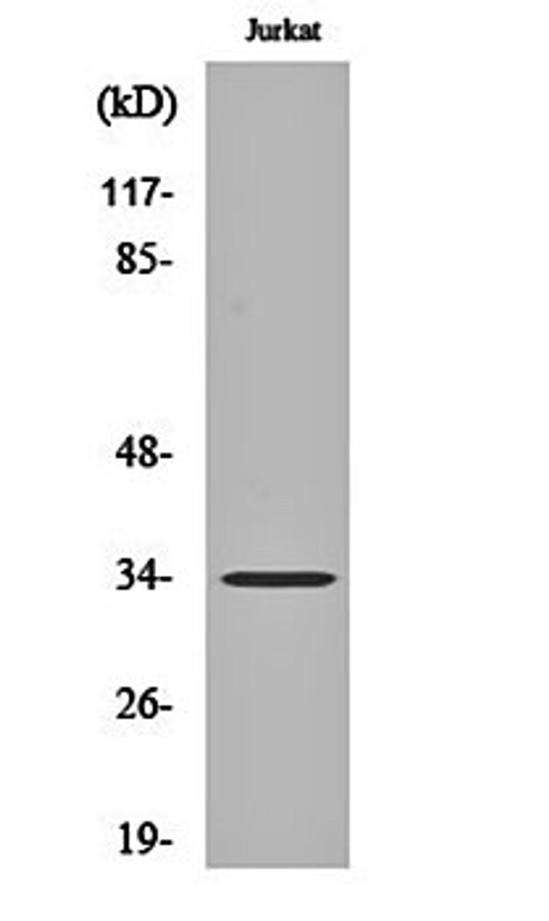 Western blot analysis of Jurkat cell lysates using Olfactory receptor 4C12 antibody