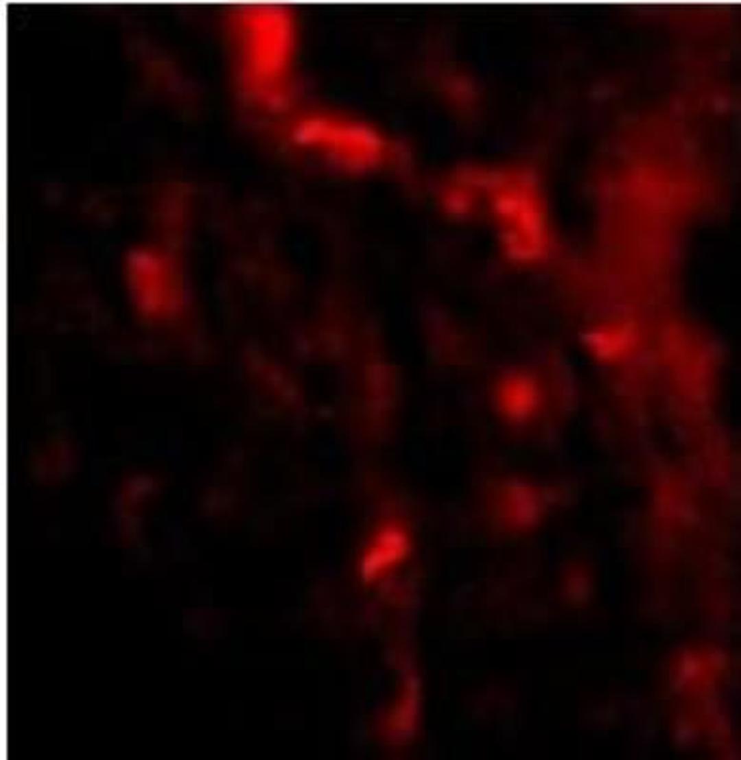 Immunocytochemistry/Immunofluorescence: IRGM Antibody [NBP1-76890] - of IRGM in Human Brain cells. Dilution: 20 ug/mL.