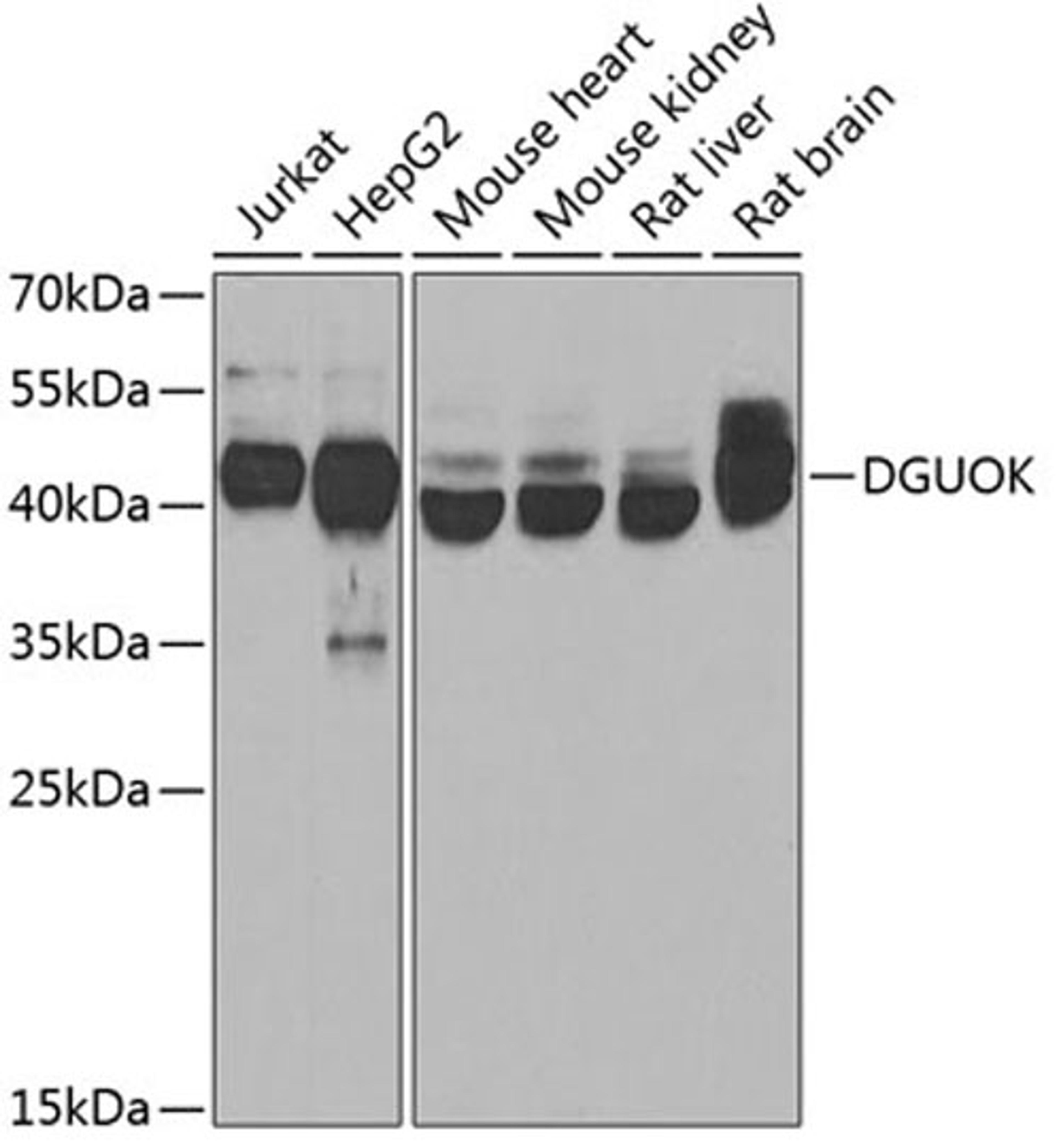 Western blot - DGUOK antibody (A6898)