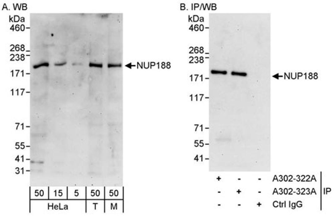 Detection of human and mouse NUP188 by WB and IP.