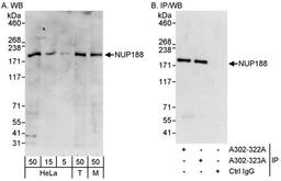 Detection of human and mouse NUP188 by WB and IP.