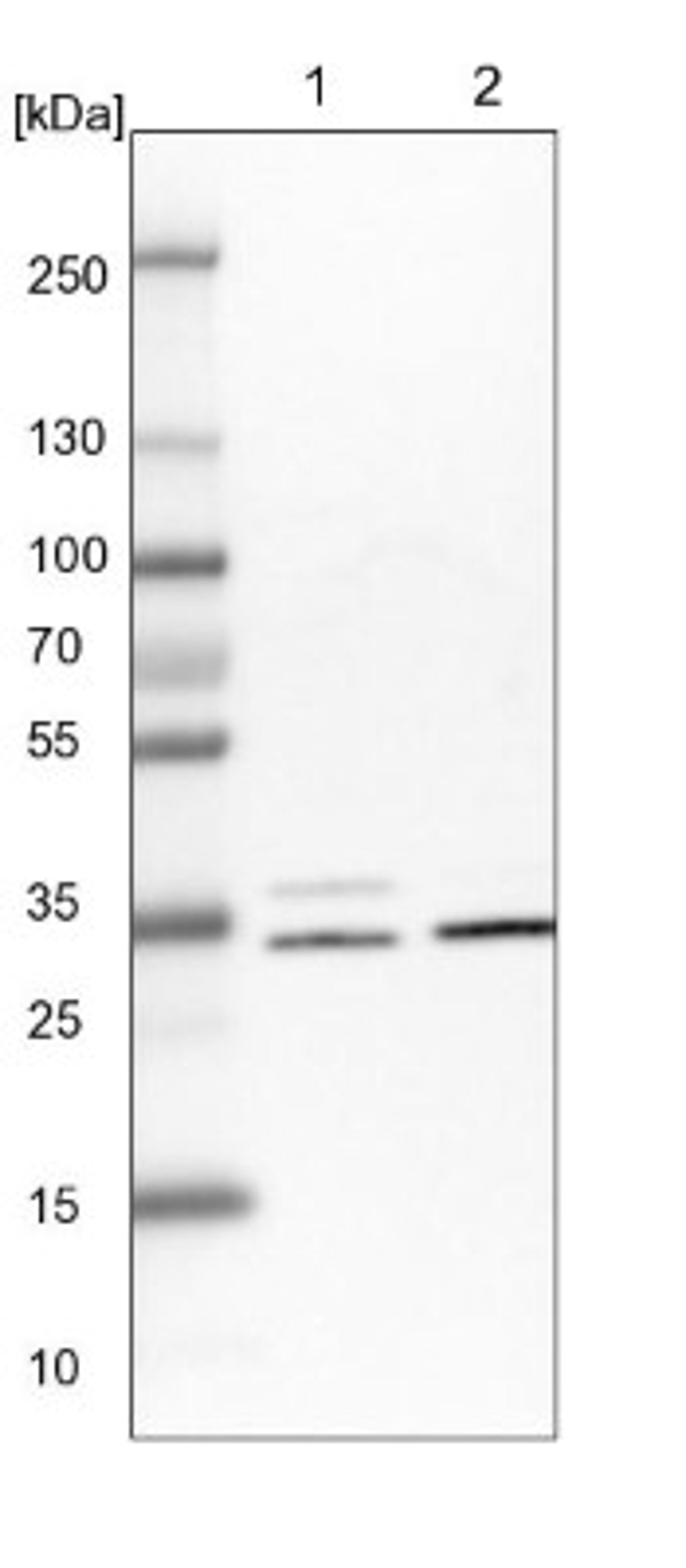 Western Blot: CDV3 Antibody [NBP1-81779] - Lane 1: NIH-3T3 cell lysate (Mouse embryonic fibroblast cells)<br/>Lane 2: NBT-II cell lysate (Rat Wistar bladder tumour cells)