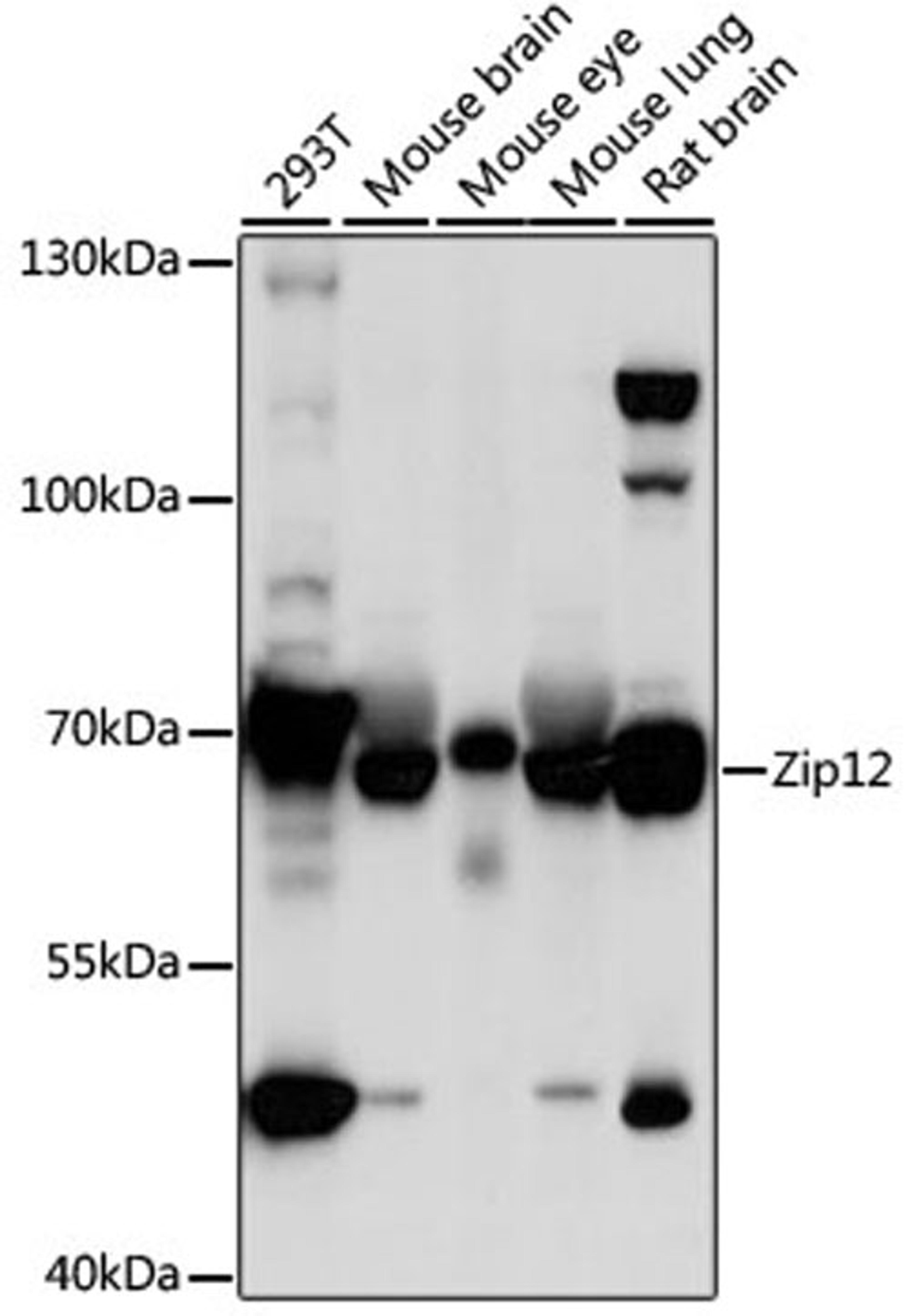 Western blot - Zip12 antibody (A16006)