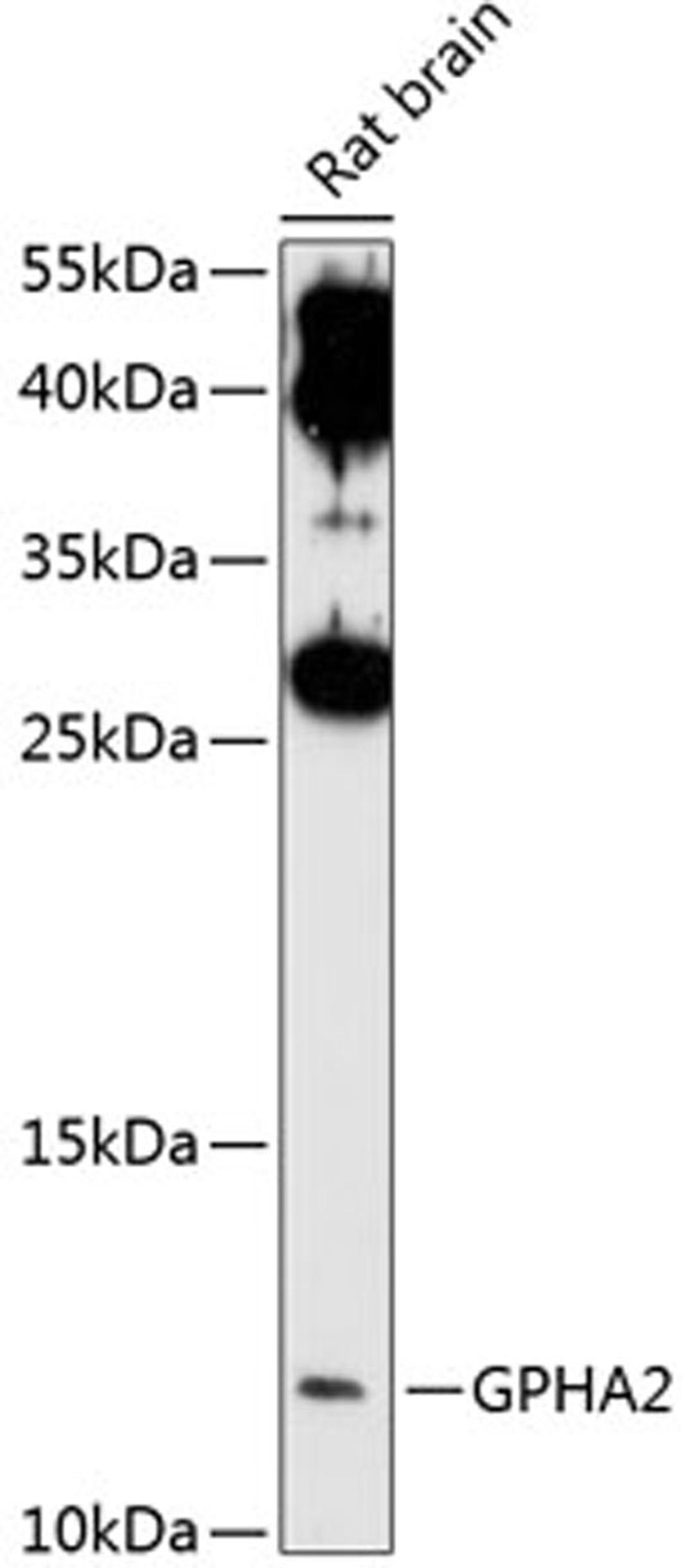 Western blot - GPHA2 antibody (A10601)