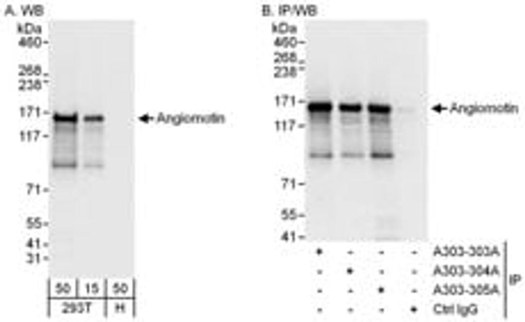 Detection of human Angiomotin by western blot and immunoprecipitation.