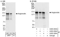 Detection of human Angiomotin by western blot and immunoprecipitation.