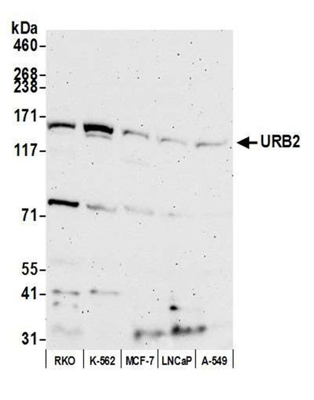 Detection of human URB2 by WB.