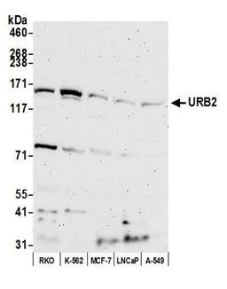 Detection of human URB2 by WB.