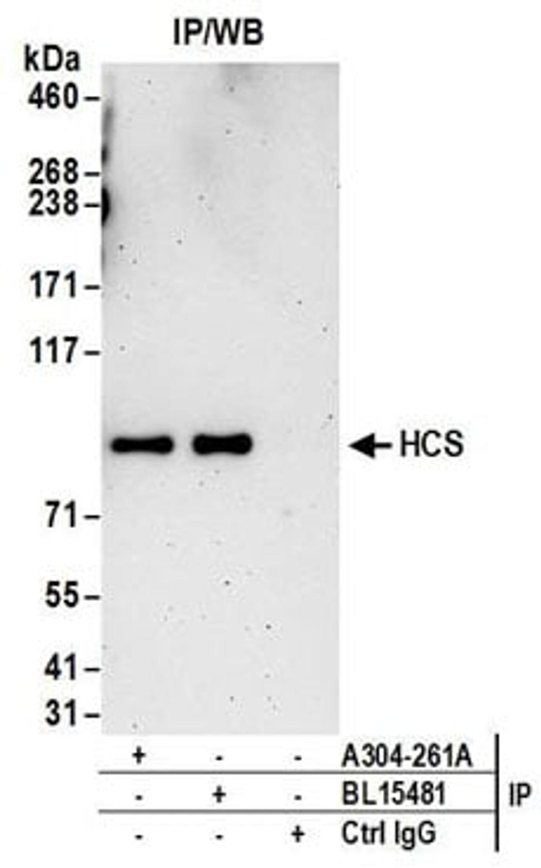 Detection of human HCS by western blot of immunoprecipitates.