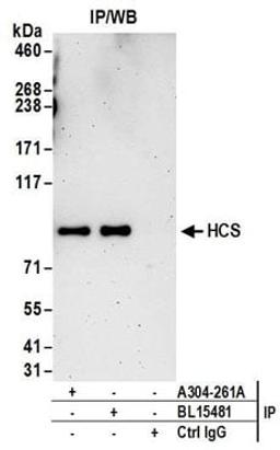 Detection of human HCS by western blot of immunoprecipitates.