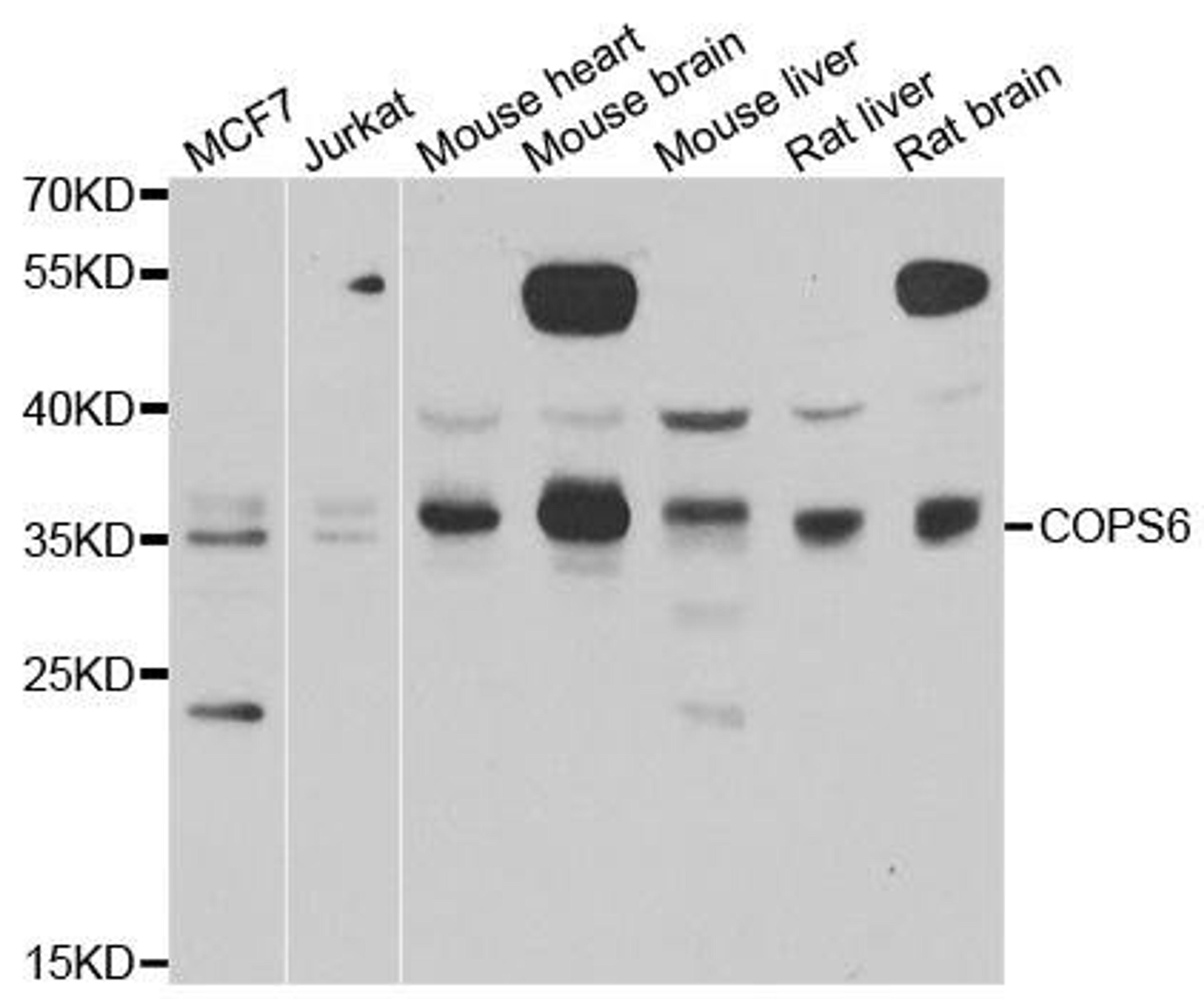 Western blot analysis of extracts of various cell lines using COPS6 antibody