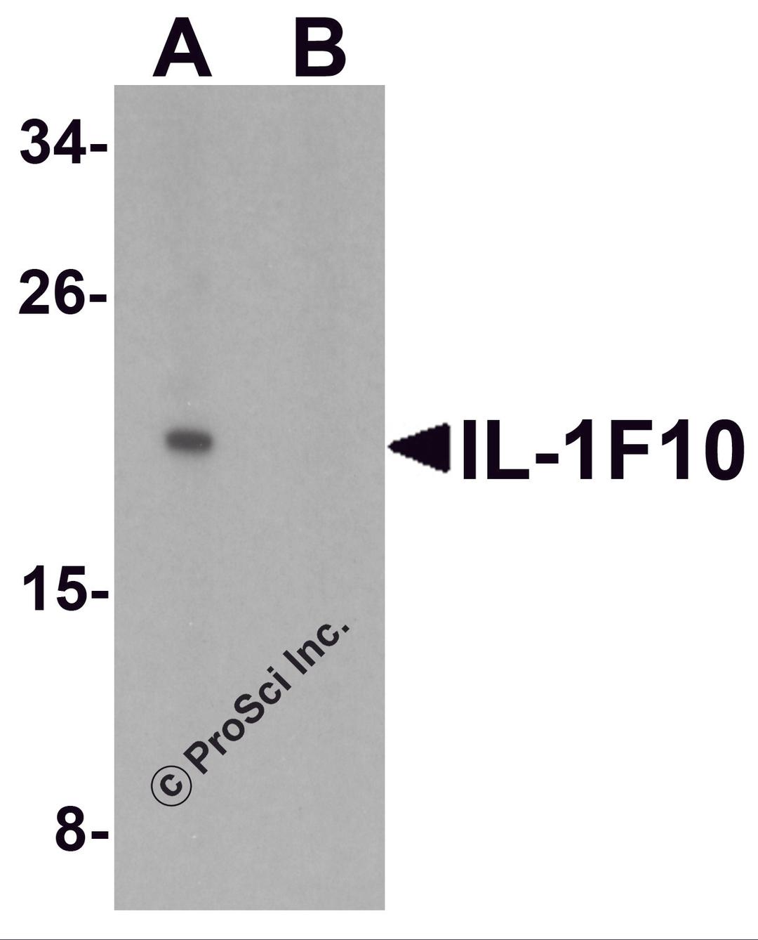 Western blot analysis of IL-1F10 in human liver tissue lysate with IL-1F10 antibody at 1 μg/ml in (A) the absence and (B) the presence of blocking peptide.