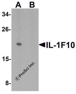 Western blot analysis of IL-1F10 in human liver tissue lysate with IL-1F10 antibody at 1 μg/ml in (A) the absence and (B) the presence of blocking peptide.