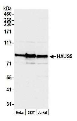 Detection of human HAUS5 by WB.