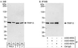 Detection of human TRIP13 by western blot and immunoprecipitation.