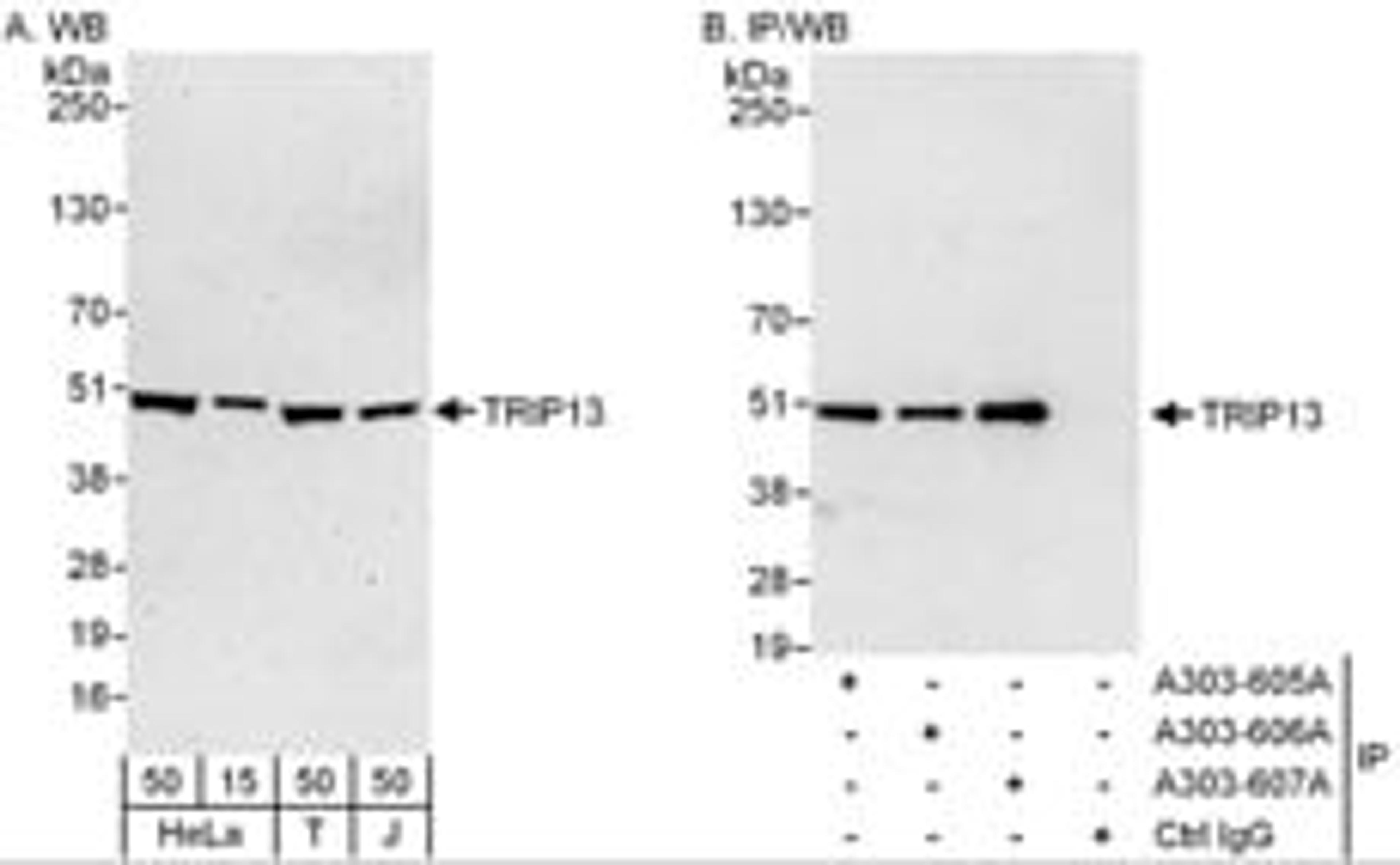 Detection of human TRIP13 by western blot and immunoprecipitation.