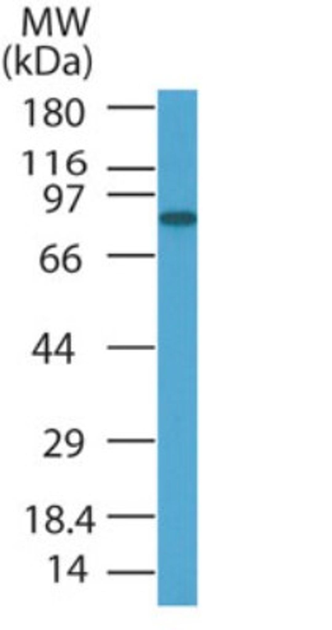 Western Blot: PRDM5 Antibody [NB100-56419] - analysis of PRDM5 in HL60 cell lysate using this antibody.