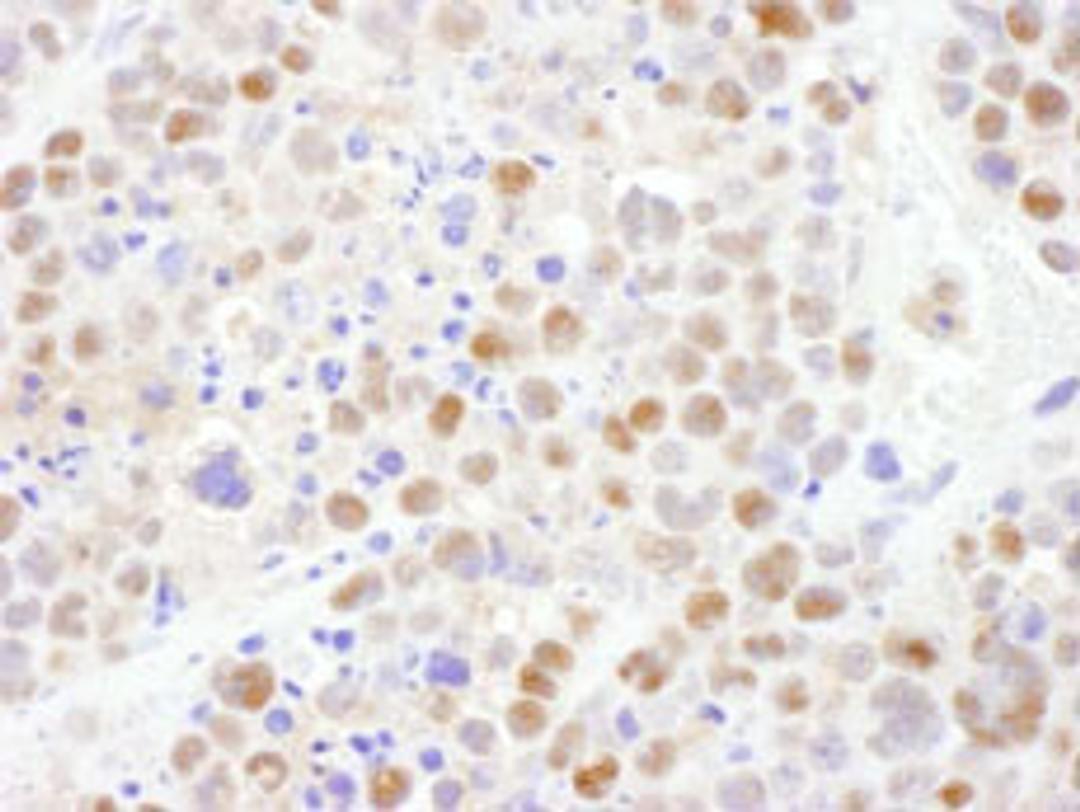 Detection of mouse CRM1 by immunohistochemistry.