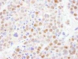 Detection of mouse CRM1 by immunohistochemistry.