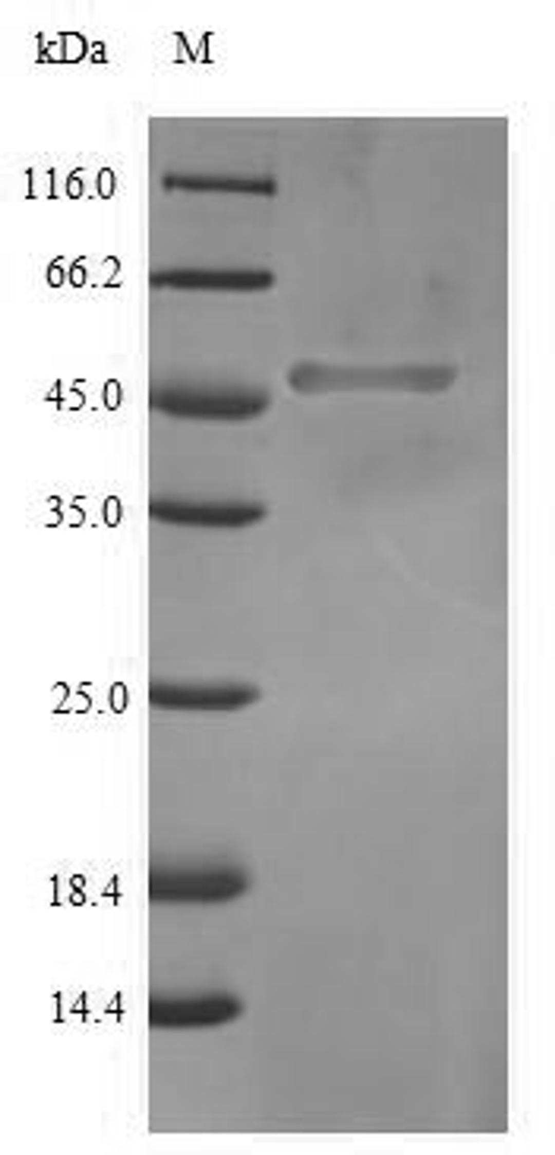 (Tris-Glycine gel) Discontinuous SDS-PAGE (reduced) with 5% enrichment gel and 15% separation gel.