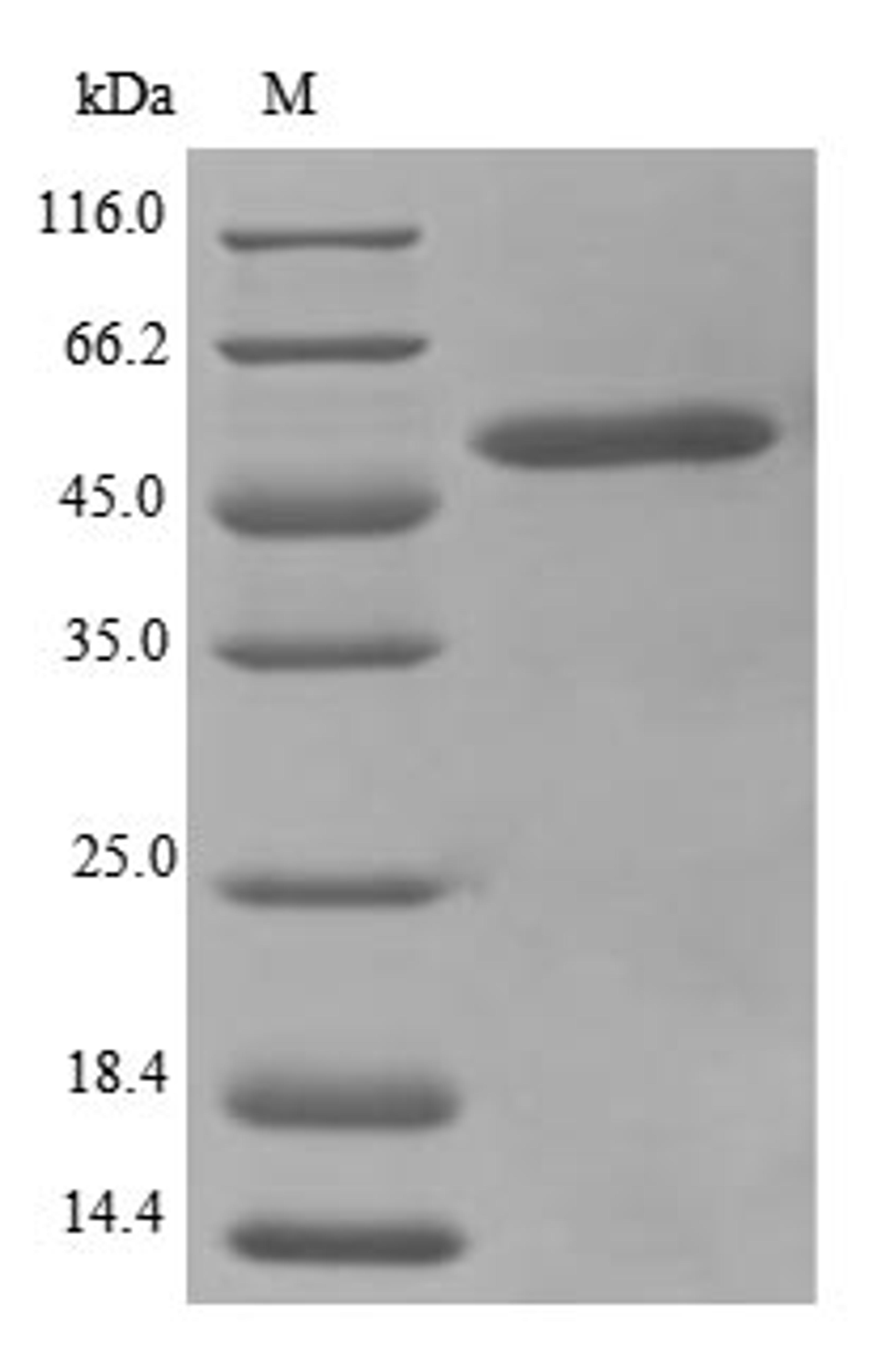 (Tris-Glycine gel) Discontinuous SDS-PAGE (reduced) with 5% enrichment gel and 15% separation gel.