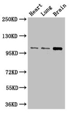 Western Blot. Positive WB detected in: Mouse heart tissue, Mouse lung tissue, Mouse brain tissue. All lanes: RBM10 antibody at 3µg/ml. Secondary. Goat polyclonal to rabbit IgG at 1/50000 dilution. Predicted band size: 104, 95, 111 kDa. Observed band size: 104 kDa