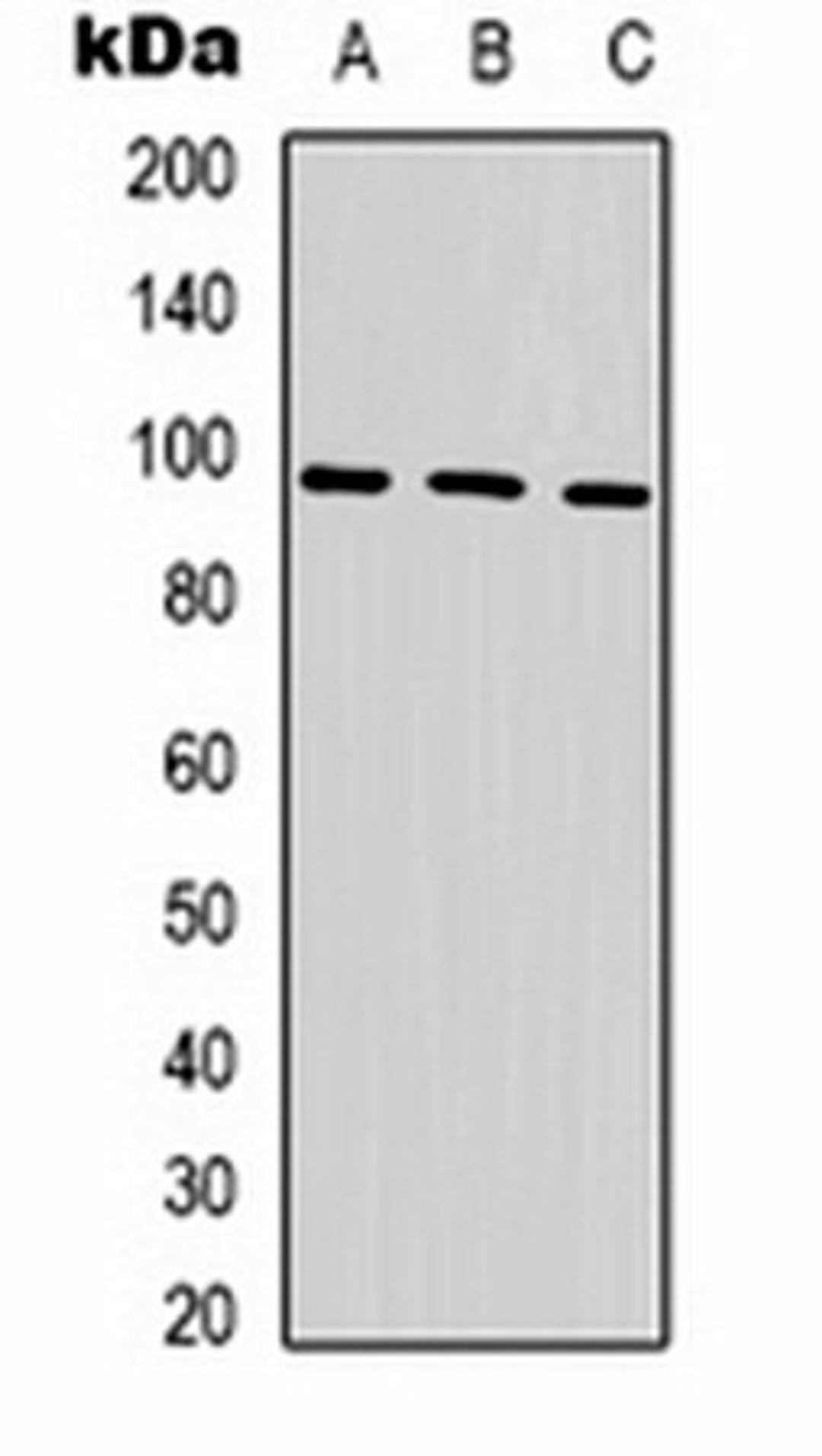 Western blot analysis of Hela (Lane 1), mouse brain (Lane 2), rat brain (Lane 3) whole cell lysates using HSP90 alpha antibody