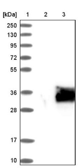 Western Blot: Homeobox protein SIX6 Antibody [NBP1-82478] - Lane 1: Marker [kDa] 250, 130, 95, 72, 55, 36, 28, 17, 10<br/>Lane 2: Negative control (vector only transfected HEK293T lysate)<br/>Lane 3: Over-expression lysate (Co-expressed with a C-terminal myc-DDK tag (~3.1 kDa) in mammalian HEK293T cells, LY416023)