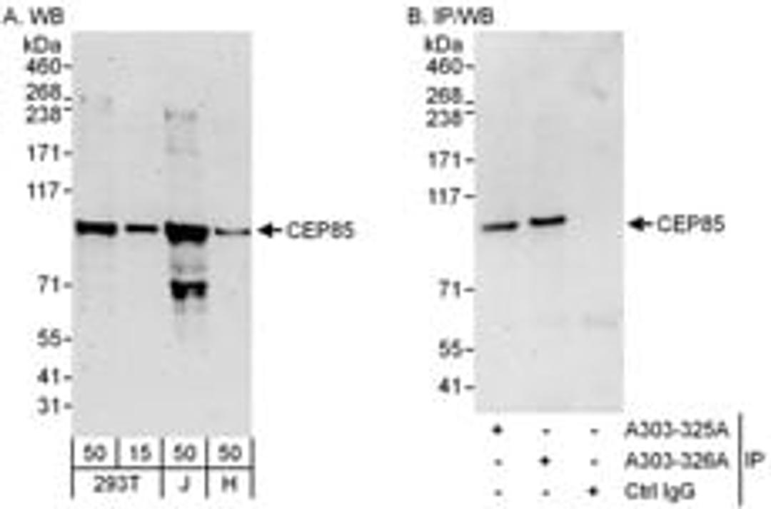 Detection of human CEP85 by western blot and immunoprecipitation.