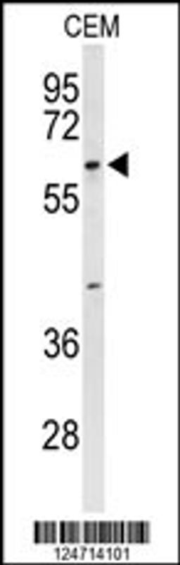 Western blot analysis of TCHP Antibody in CEM cell line lysates (35ug/lane)