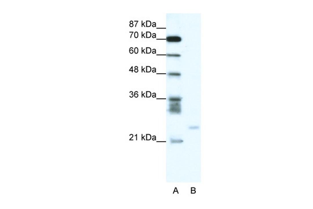 Antibody used in WB on Human Jurkat 0.2-1 ug/ml.