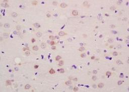 Immunohistochemical analysis of formalin-fixed paraffin embedded rat brain tissue using SLCO1C1 antibody (dilution at 1:200)