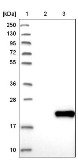 Western Blot: DPH4 Antibody [NBP1-87969] - Lane 1: Marker [kDa] 250, 130, 95, 72, 55, 36, 28, 17, 10<br/>Lane 2: Negative control (vector only transfected HEK293T lysate)<br/>Lane 3: Over-expression lysate (Co-expressed with a C-terminal myc-DDK tag (~3.1 kDa) in mammalian HEK293T cells, LY405653)