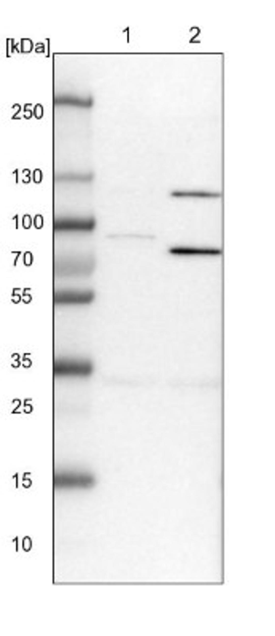 Western Blot: SPATA5 Antibody [NBP1-89214] - Lane 1: NIH-3T3 cell lysate (Mouse embryonic fibroblast cells)<br/>Lane 2: NBT-II cell lysate (Rat Wistar bladder tumour cells)