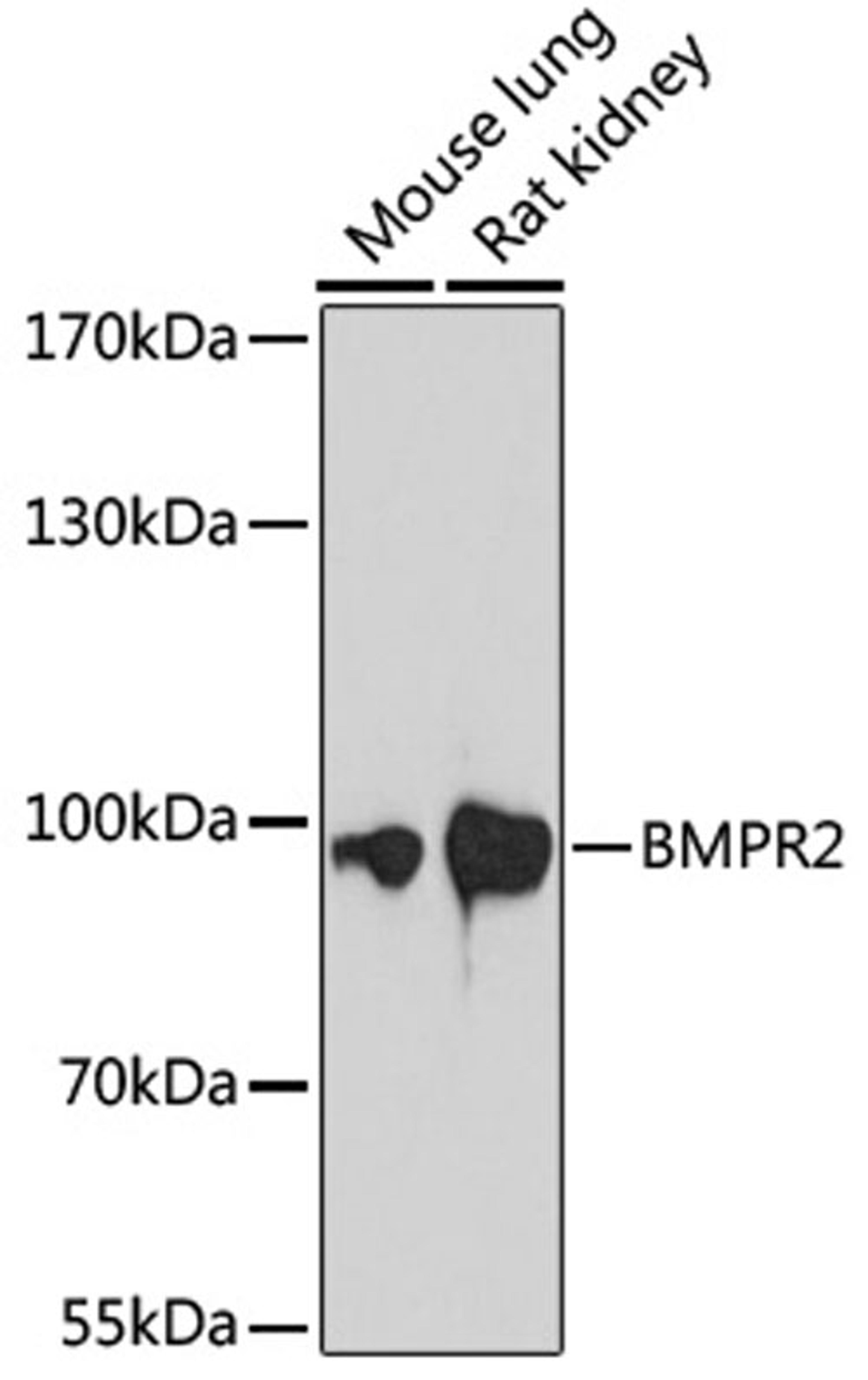 Western blot - BMPR2 antibody (A16778)