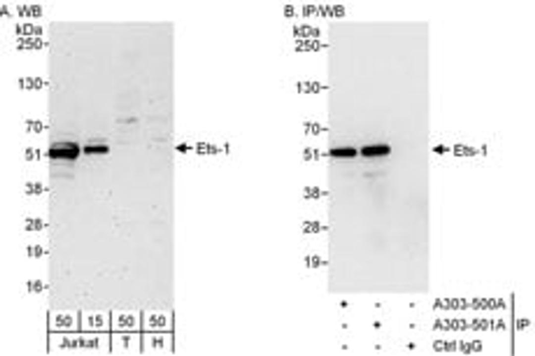 Detection of human Ets-1 by western blot and immunoprecipitation.