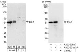 Detection of human Ets-1 by western blot and immunoprecipitation.