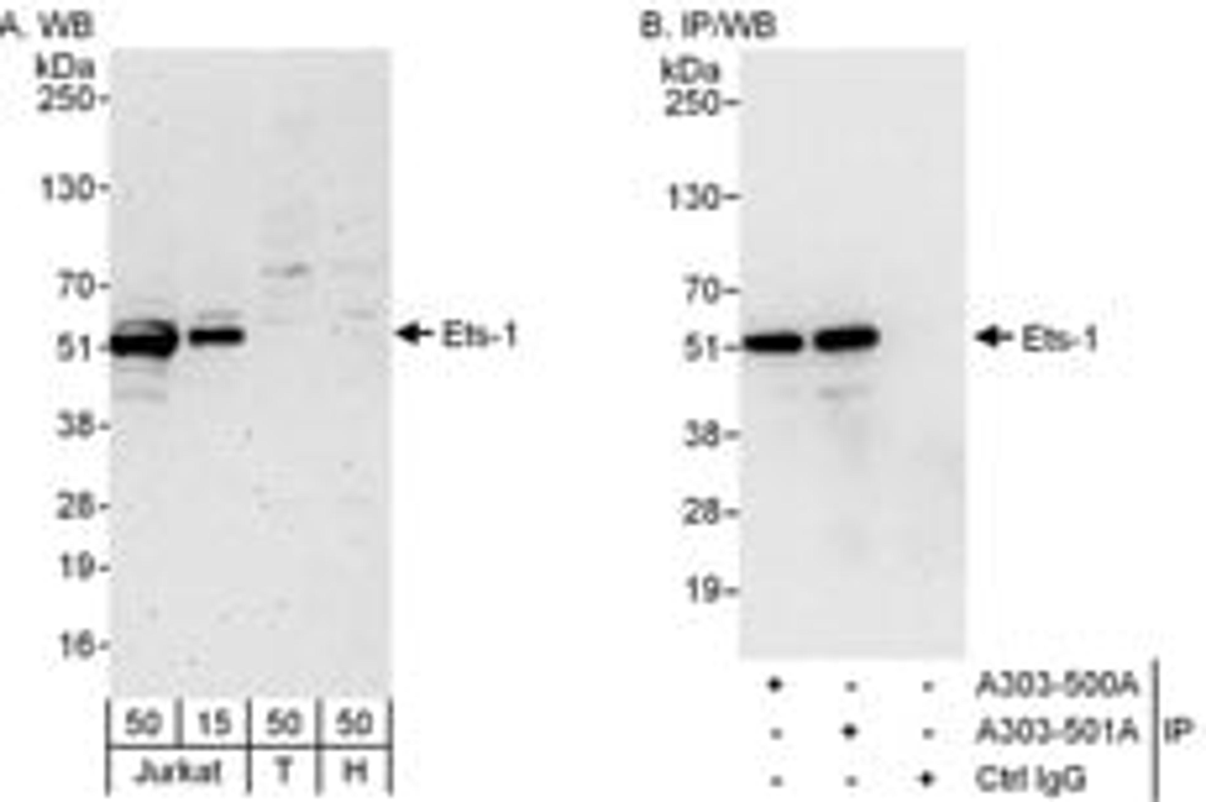 Detection of human Ets-1 by western blot and immunoprecipitation.