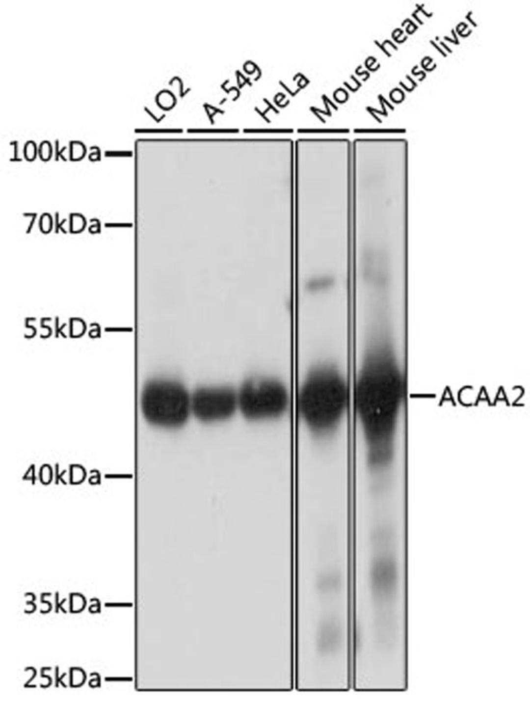 Western blot - ACAA2 antibody (A15778)