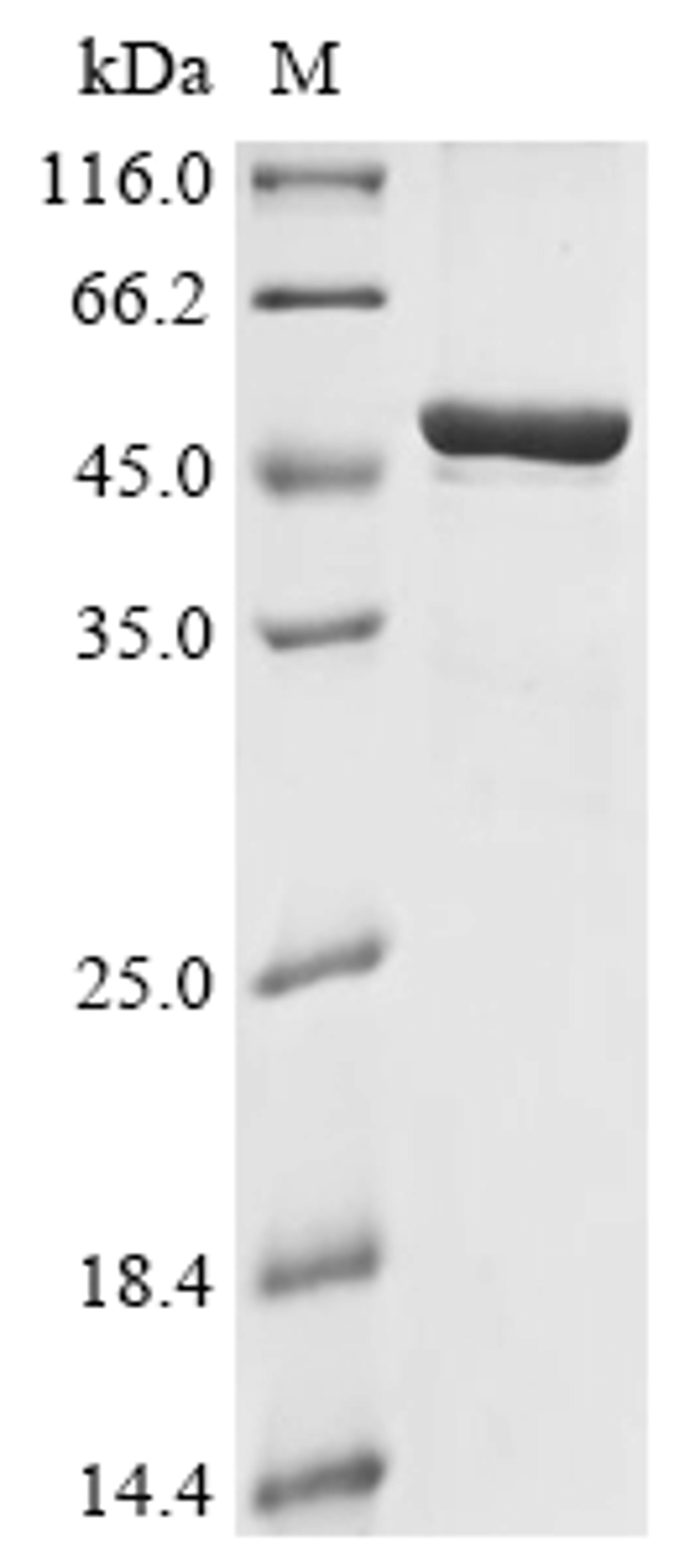 (Tris-Glycine gel) Discontinuous SDS-PAGE (reduced) with 5% enrichment gel and 15% separation gel.