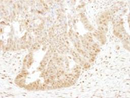 Detection of human PSMB4 by immunohistochemistry.