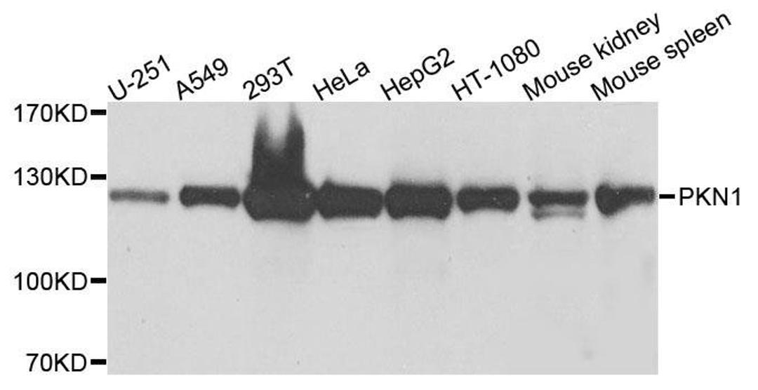 Western blot analysis of extracts of various cells using PRK1 antibody