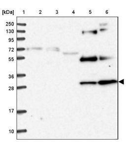 Western Blot: Nrip2 Antibody [NBP1-85033] - Lane 1: Marker [kDa] 250, 130, 95, 72, 55, 36, 28, 17, 10<br/>Lane 2: Human cell line RT-4<br/>Lane 3: Human cell line U-251MG sp<br/>Lane 4: Human plasma (IgG/HSA depleted)<br/>Lane 5: Human liver tissue<br/>Lane 6: Human tonsil tissue