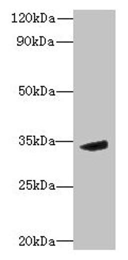 Western blot. All lanes: MPPED2 antibody at 6µg/ml + Mouse brain tissue. Secondary. Goat polyclonal to rabbit IgG at 1/10000 dilution. Predicted band size: 34, 32 kDa. Observed band size: 34 kDa