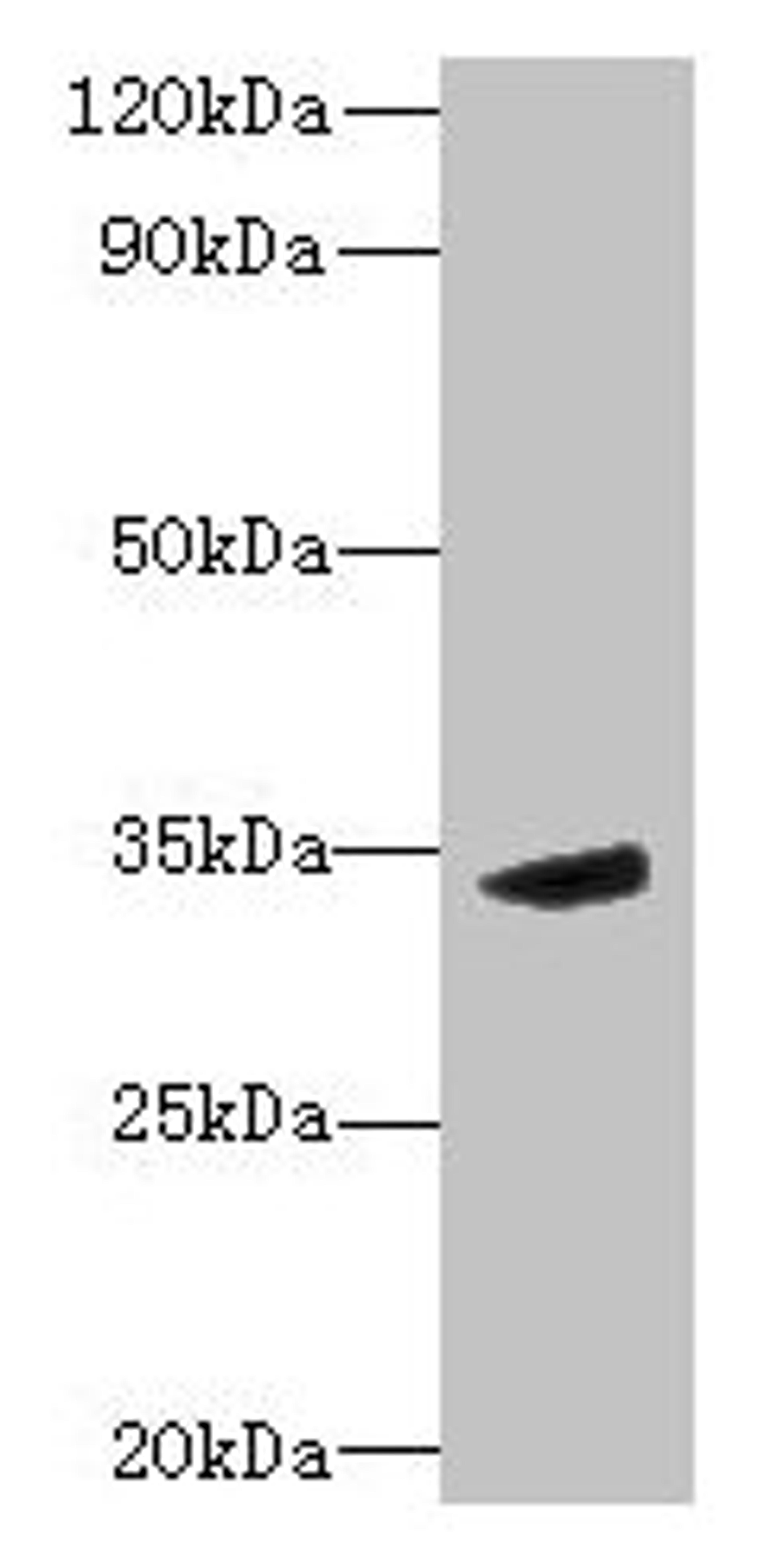 Western blot. All lanes: MPPED2 antibody at 6µg/ml + Mouse brain tissue. Secondary. Goat polyclonal to rabbit IgG at 1/10000 dilution. Predicted band size: 34, 32 kDa. Observed band size: 34 kDa