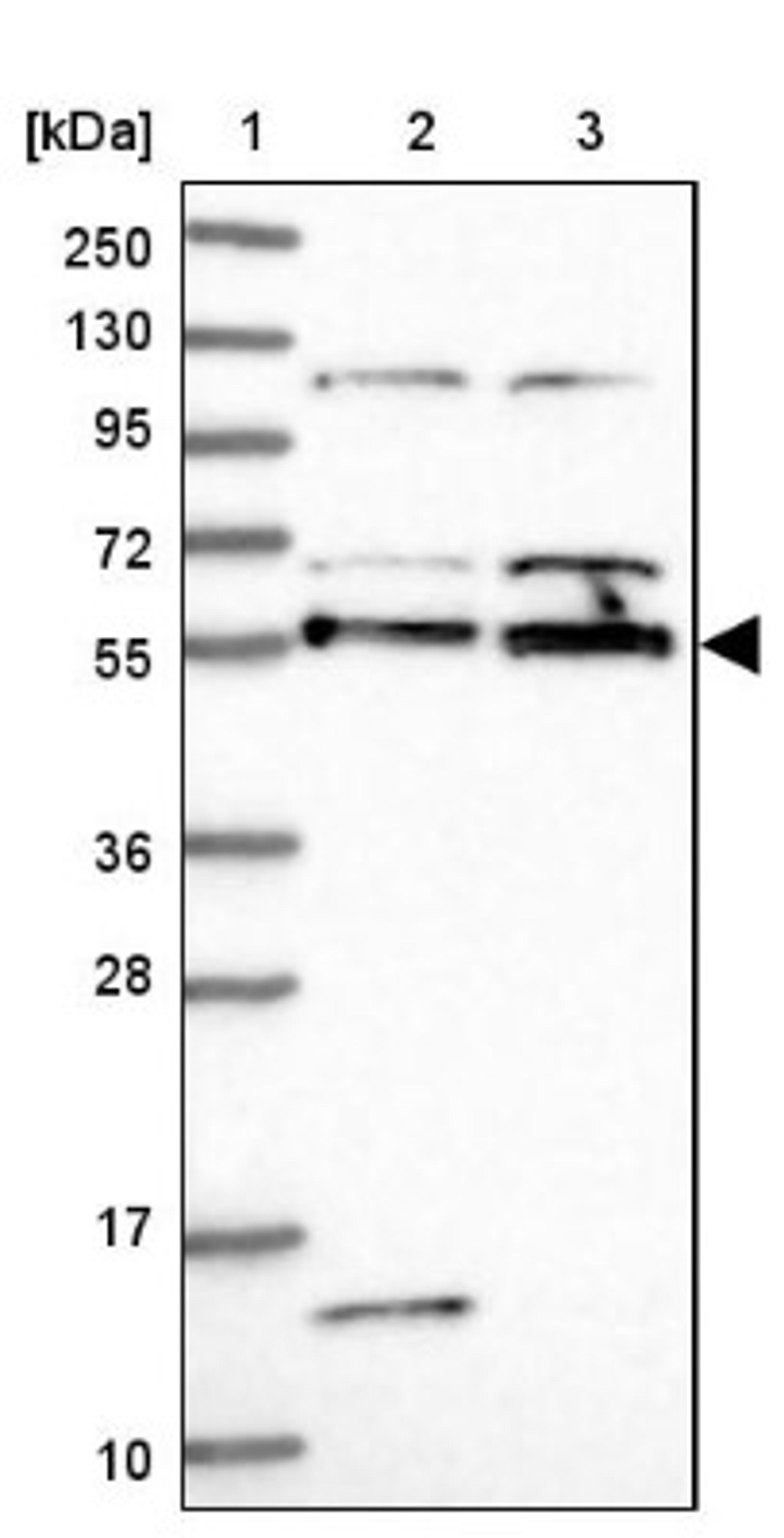 Western Blot: ACRBP Antibody [NBP1-85407] - Lane 1: Marker [kDa] 250, 130, 95, 72, 55, 36, 28, 17, 10<br/>Lane 2: Human cell line RT-4<br/>Lane 3: Human cell line U-251MG sp