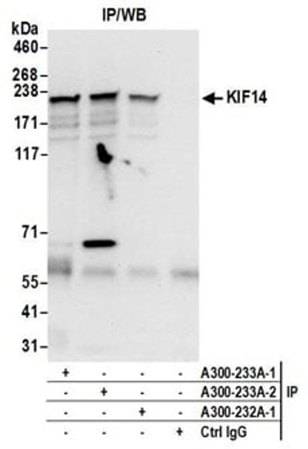 Detection of human KIF14 by western blot of immunoprecipitates.