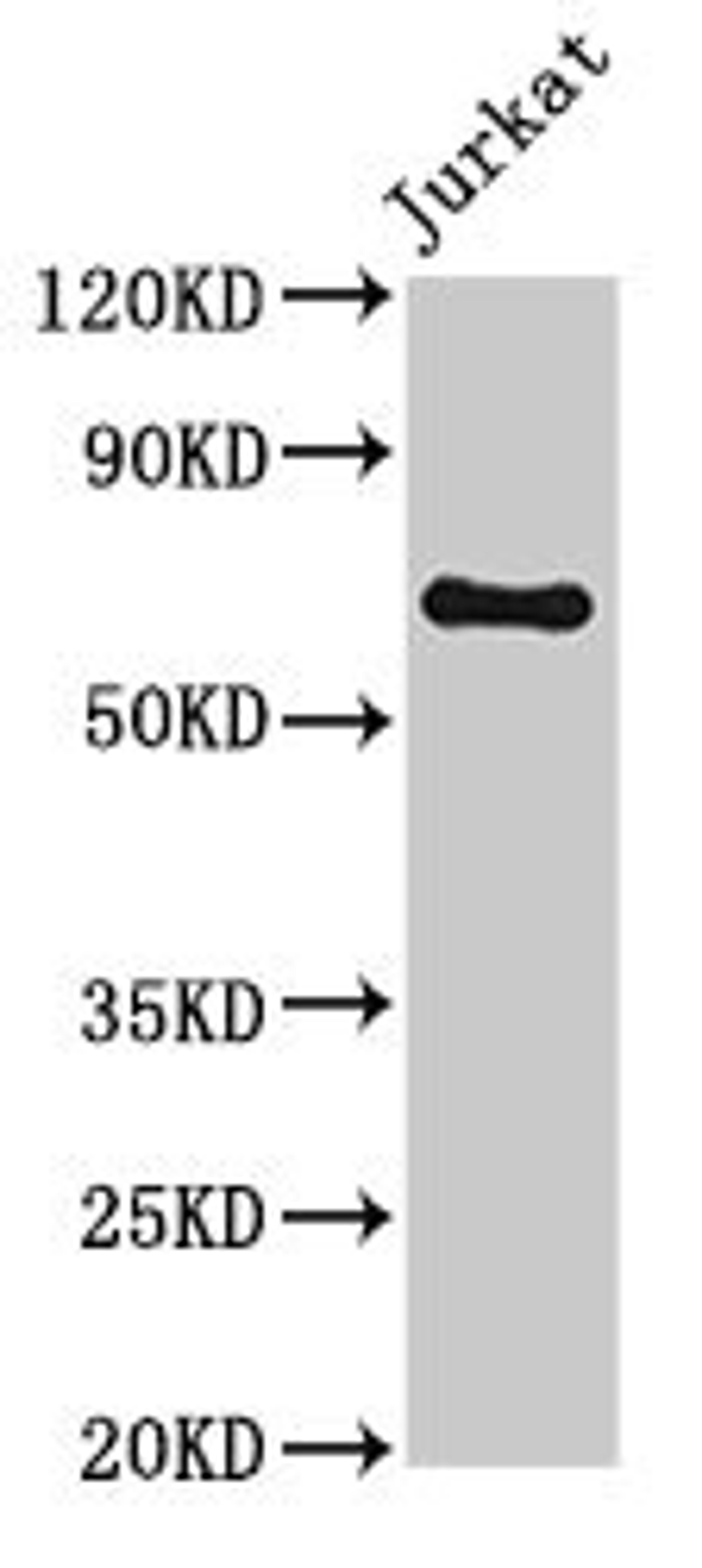 Western Blot. Positive WB detected in: Jurkat whole cell lysate. All lanes: GNL1 antibody at 3.2µg/ml. Secondary. Goat polyclonal to rabbit IgG at 1/50000 dilution. Predicted band size: 69, 48 kDa. Observed band size: 69 kDa