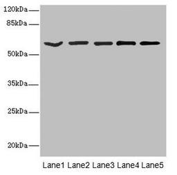 Western blot. All lanes: ASIC3 antibody at 2.4µg/ml. Lane 1: Jurkat whole cell lysate. Lane 2: HepG2 whole cell lysate. Lane 3: Hela whole cell lysate. Lane 4: A549 whole cell lysate. Lane 5: A431 whole cell lysate. Secondary. Goat polyclonal to rabbit IgG at 1/10000 dilution. Predicted band size: 59, 61, 45 kDa. Observed band size: 59 kDa